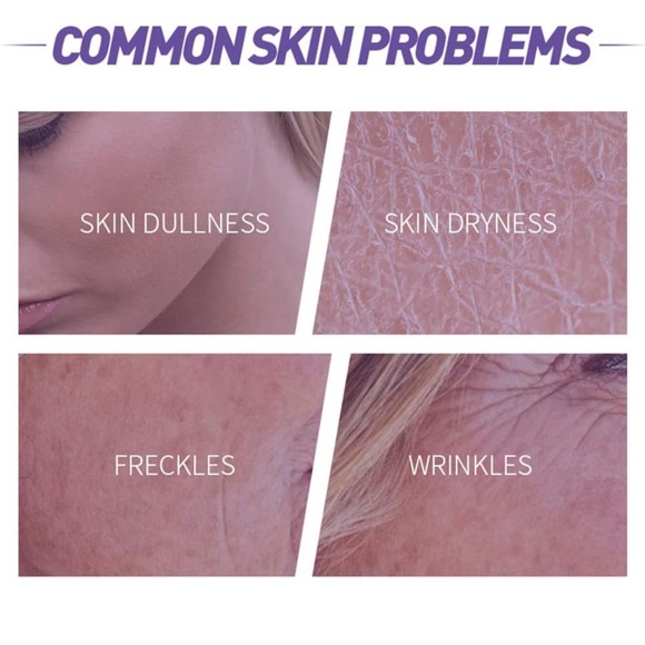 Blueberry Face Serum Sodium Hyaluronic Acid Pure Skin - Picture 3 of 6